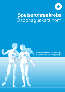 Speiseröhrenkrebs - Krebsliga Schweiz