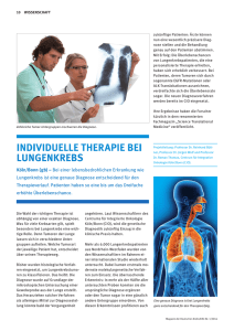 individuelle therapie bei lungenkrebs