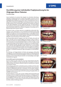 Durchführung einer individuellen Prophylaxesitzung bei der
