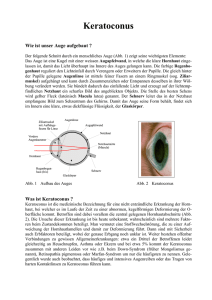 Keratoconus - Augenärzte Thun und Umgebung