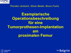 Exemplarische Operationsbeschreibung für eine Tumorprothesen