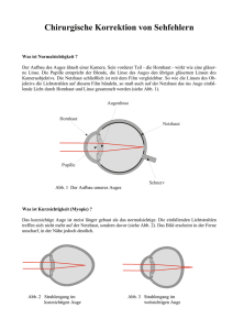 Chirurgische Korrektur von Fehlsichtigkeiten