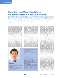 Retention und Widerstandsform bei zementierten Kronen und Brücken