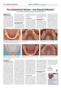 Dental Tribune - Fixe Retainer