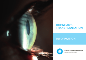 Infobroschüre Hornhauttransplantation