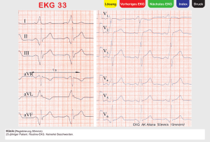 EKG 33 - Extras Springer