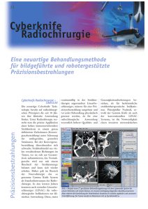 Cyberknife Radiochirurgie - Institut für Robotik und Kognitive Systeme
