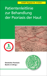 Leitlinie zur Therapie der Psoriasis vulgaris