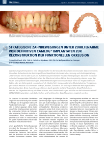 Strategische Zahnbewegungen