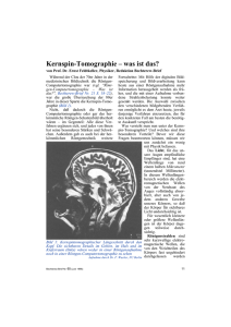 Kernspin-Tomographie – was ist das?