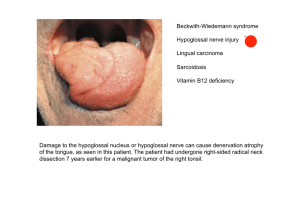 Beckwith-Wiedemann syndrome Hypoglossal nerve injury Lingual