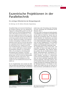 Exzentrische Projektionen in der Paralleltechnik