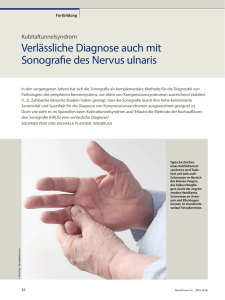 Verlässliche Diagnose auch mit Sonografie des Nervus ulnaris