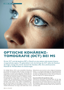 OPTISCHE KOHÄRENZ- TOMOGRAFIE (OCT) BEI MS