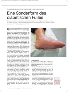 Eine Sonderform des diabetischen Fußes