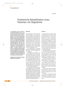 Prothetische Rehabilitation eines Patienten mit Oligodontie