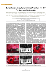 Einsatz von Knochenersatzmaterialien bei der