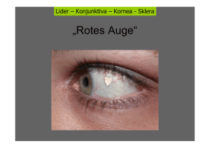 Rotes Auge