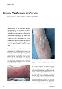Gestörte Hautbarriere bei Psoriasis