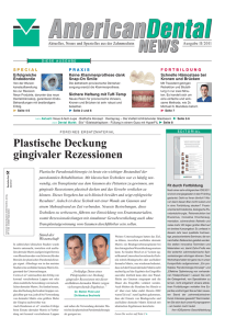 Plastische Deckung gingivaler Rezessionen