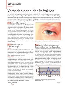 Veränderungen der Refraktion, Augenspiegel 10/2004