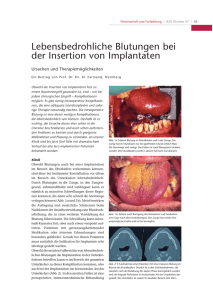 Lebensbedrohliche Blutungen bei der Insertion von Implantaten