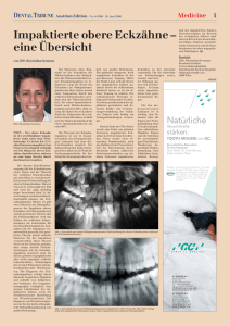 Impaktierte obere Eckzähne - Dental Tribune International