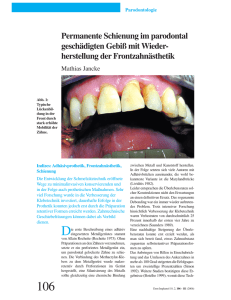 Permanente Schienung im parodontal geschädigten Gebiß mit Wieder