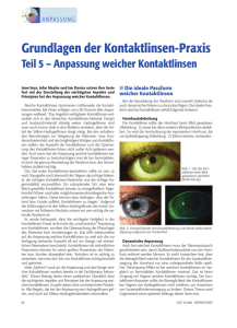 Grundlagen der Kontaktlinsen-Praxis