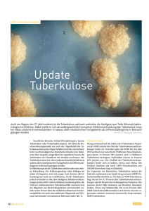 Update Tuberkulose - LKH Hörgas