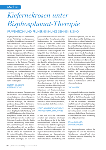 Kiefernekrosen unter Bisphosphonat-Therapie