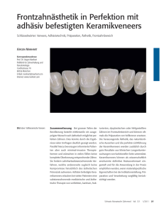 Frontzahnästhetik in Perfektion mit adhäsiv befestigten