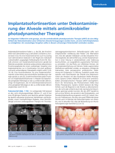 rung der Alveole mittels antimikrobieller