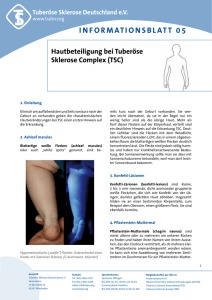 Infoblatt 05 Hautbeteiligung - Tuberöse Sklerose Deutschland eV