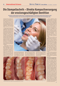 Direkte Kompositversorgung der erosionsgeschädigten Dentition