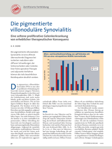 Die pigmentierte villonoduläre Synovialitis