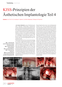 KISS-Prinzipien der Ästhetischen Implantologie Teil 4