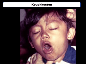 34. Keuchhusten  - free-new