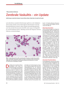 Zerebrale Vaskulitis – ein Update