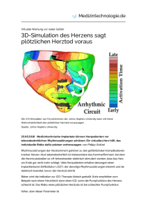 3D-Simulation des Herzens sagt plötzlichen Herztod voraus