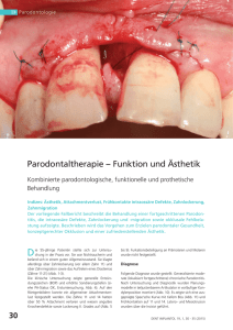 Parodontaltherapie − Funktion und Ästhetik