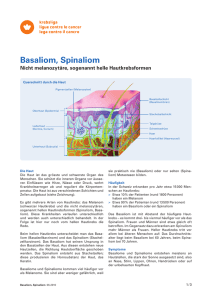 Basaliom-Spinaliom - helle Hautkrebsformen