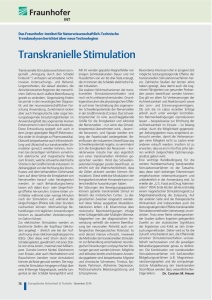 Transkranielle Stimulation