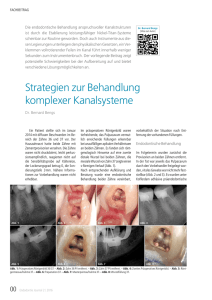 Strategien zur Behandlung komplexer Kanalsysteme