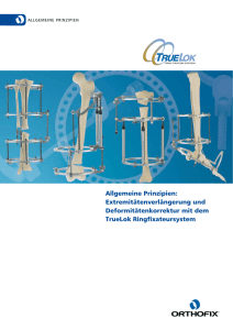 Orthofix - TrueLok - Allgemeine Grundsätze - Medeco