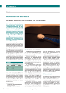 Prävention der Stomatitis | SpringerLink