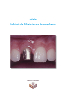 Leitfaden Endodontische Stiftretention von Kronenaufbauten