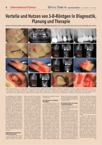 4 Vorteile und Nutzen von 3-D-Röntgen in Diagnostik, Planung und