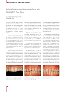 Rehabilitation der Oberkieferfront mit BRILLIANT EverGlow