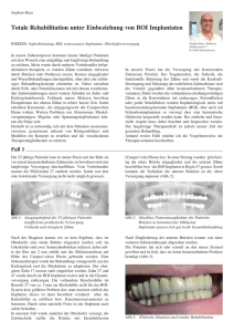 Totale Rehabilitation unter Einbeziehung von BOI Implantaten